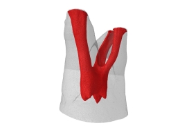 root canal