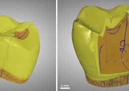 Micro-CT