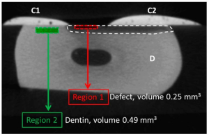 Micro-CT Dental Imaging
