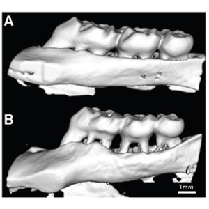 IA-Alveolar Bone Loss-S