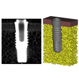 IA-Bone Imaplan Contact-S