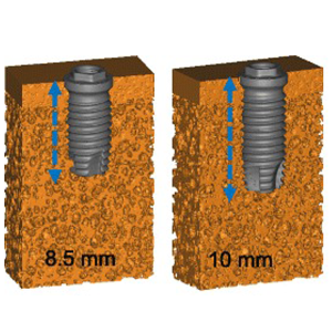 IA-Bone Imaplan Contact-S.jpg
