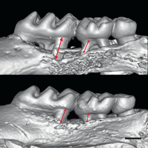 IA-Bone Regeneration-S