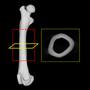 IA-Cortical Bone Thickness-S