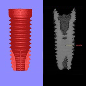 IA-Implant Geometry-S.jpg