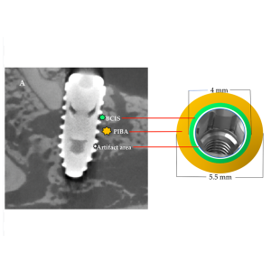 IA-Implant Surface Characteristics-S