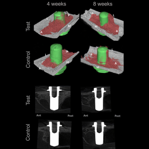 IA-Osseointegration-S