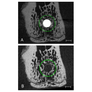 IA-Peri-Implant Bone Analysis-S